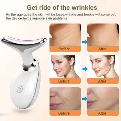 ✨Masajeador Facial Antiarrugas LED✨